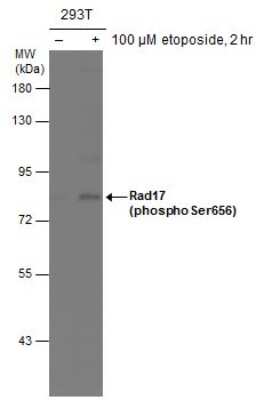 Western Blot: Rad17 [p Ser656] Antibody [NBP3-13072]